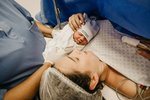 Plánování druhého císařského řezu. Kdy to říct gynekologovi?