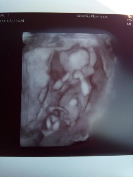 Kluk nebo holka. Tipnete si?