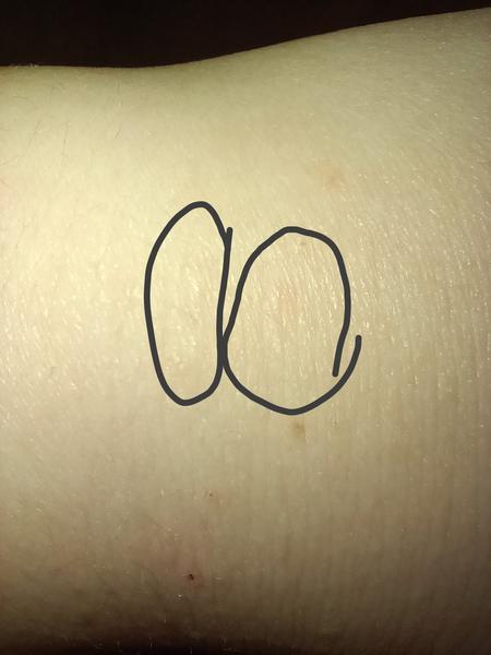 Jak rozpoznat svrab na zápěstí? Příznaky a rady