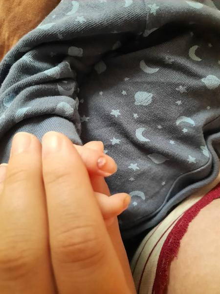 Jak řešit problémy se skvrnami na nehtech syna?