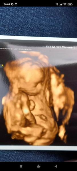 Lze pohlaví poznat z fotografie hrbolku?