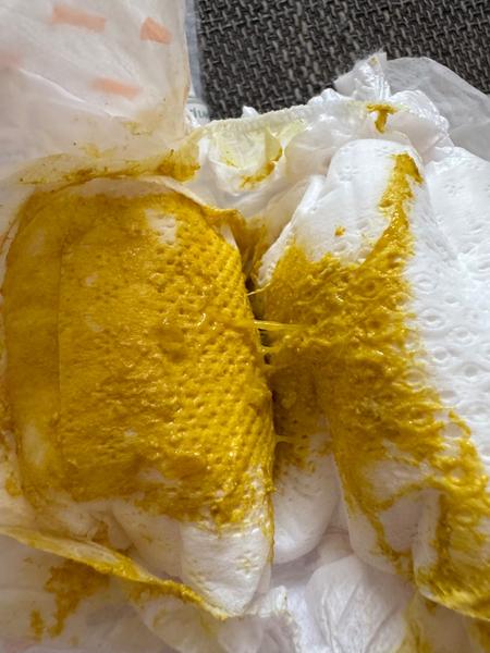 Hlenovitá stolice po změně kojeneckého mléka. Je to normální?