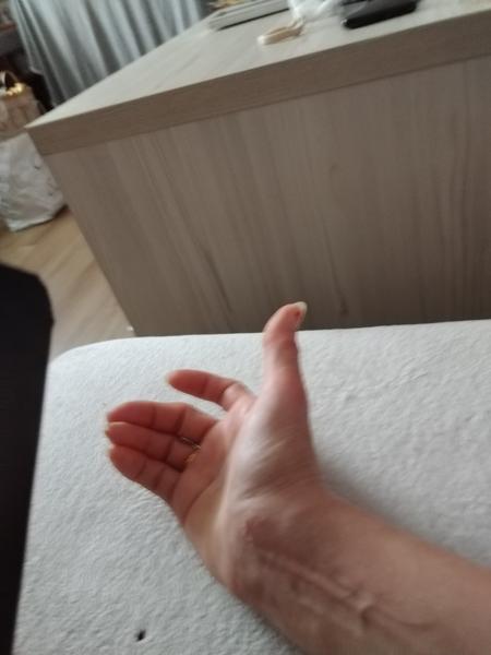 Bolest ruky, zápěstí. Co dělat?