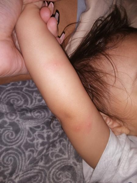 Pupínky. Co to může být?