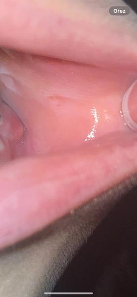 Otok u stoličky v zahraničí. Co dělat s hnisem?