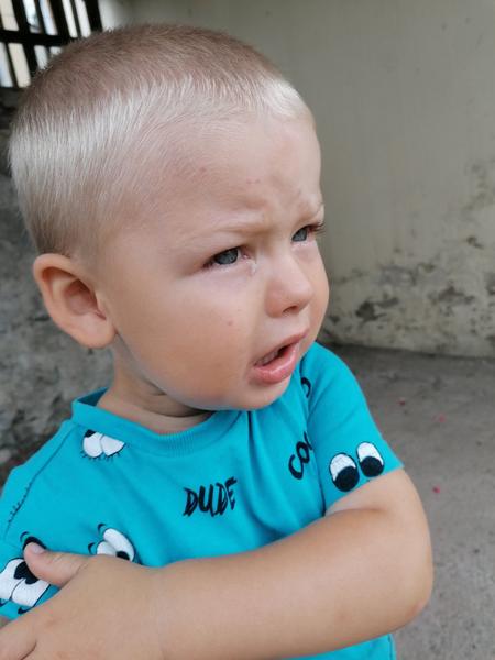 Myslíte, že to jsou neštovice?