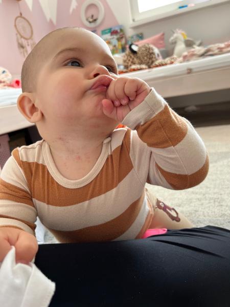 Co je to za vyrážku?