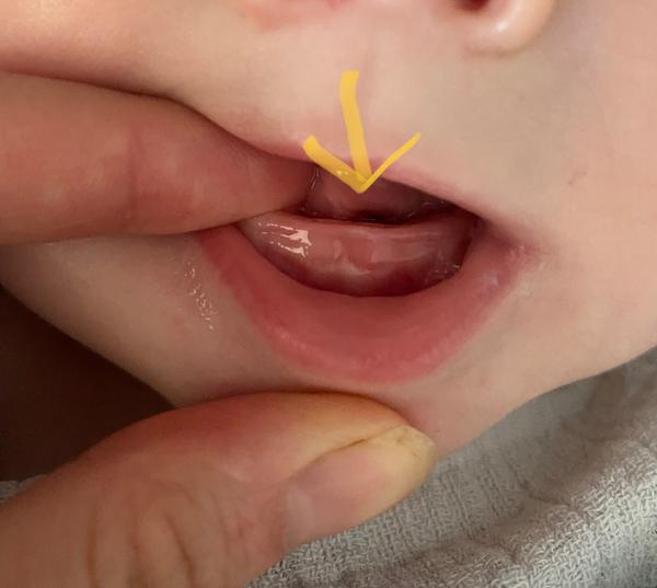 První zoubek nebo jiný důvod k neklidu u dětí?