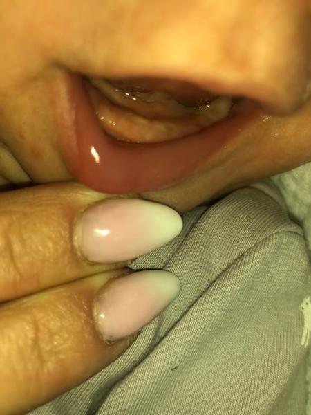 Může slintání dvouměsíčního dítěte znamenat růst zubů?