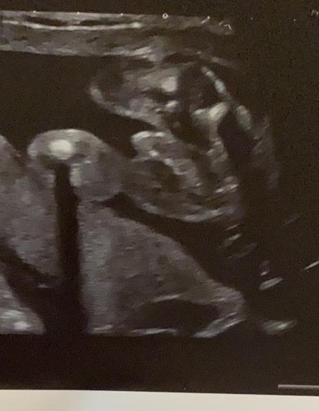 Je to holka nebo kluk? 🙂