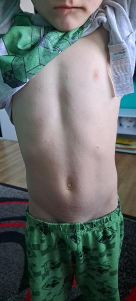 Možné příčiny svědivé vyrážky u dvouletého dítěte