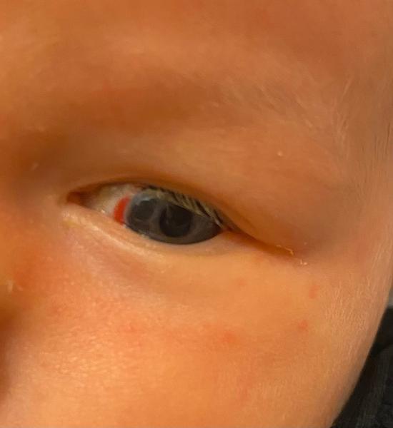 Prasklé očičko u miminka. Jak řešit tuto situaci?