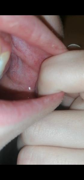 Moučnivka. Které léky opravdu zabírají?