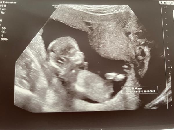 Lze z této fotky určit pohlaví?