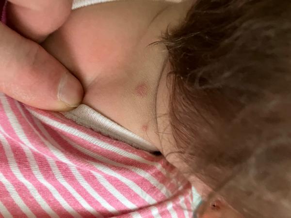 Pupínky. Co by to mohlo být?