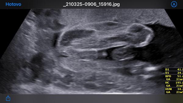 Kluk nebo holka? 🥰