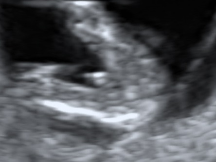 Pomůžete mi odhalit pohlaví miminka?