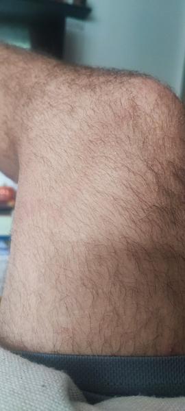 Červené ohraničení na noze. Co by to mohlo být?