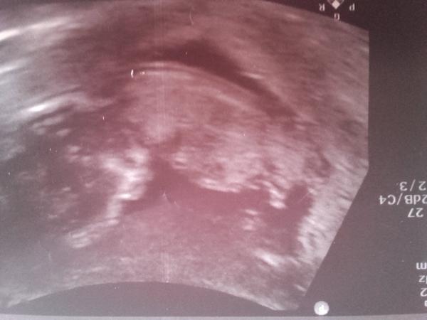 Nemůže to být nakonec holčička?