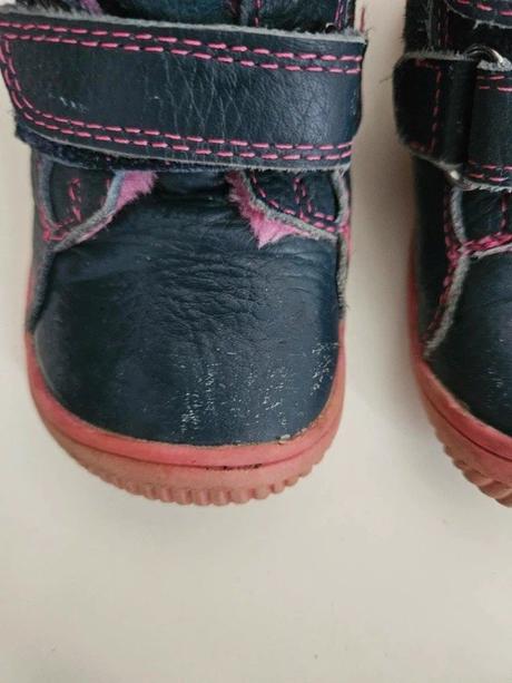 Zimní boty protetika, vel. 21, stélka 12,5 cm, protetika,21