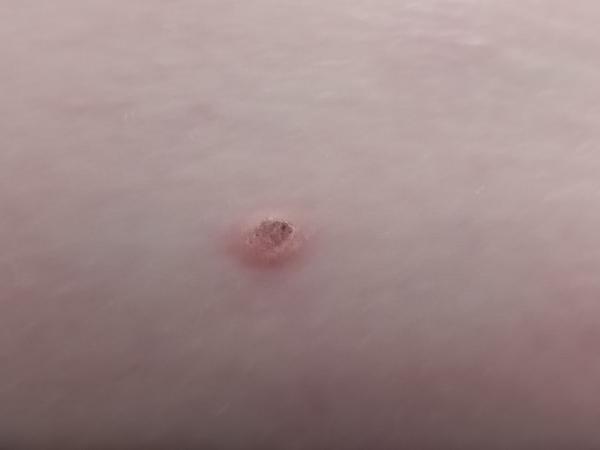 Znaménko na břiše vypadá zvláštně. Je to problém?