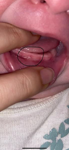 Jak poznat, zda má dítě zoubky?