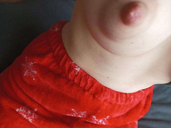 Bílý flíček na bradavce při kojení. Co to znamená?