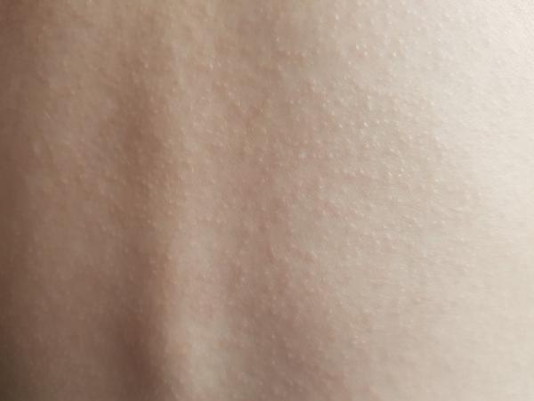 Nevíte, co způsobuje vyrážku u dětí?