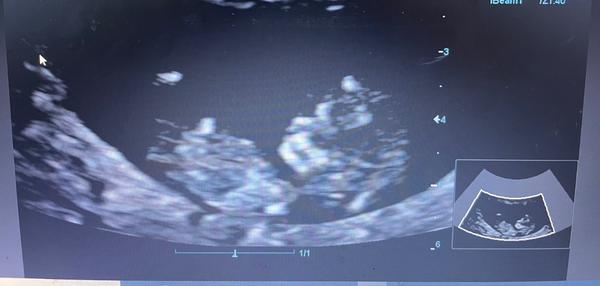 Můžete odhadnout pohlaví dítěte na základě intuice?