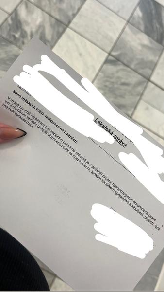 Jsem v pořádku s ganglionem na zápěstí?