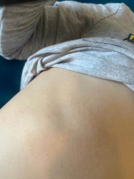 Zkušenosti s ekzémem u dětí a doporučené přípravky