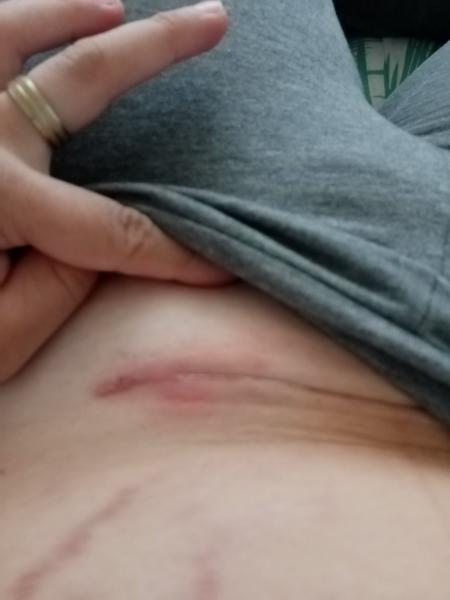 Císařsky řez. Co myslíte, že to je?