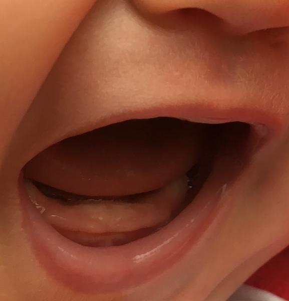 Mohou to být zoubky?