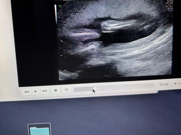 Jaké odhadujete pohlaví ve 22. týdnu těhotenství?