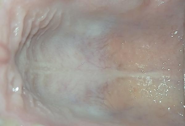 Bílé patro. Je to zvláštní?