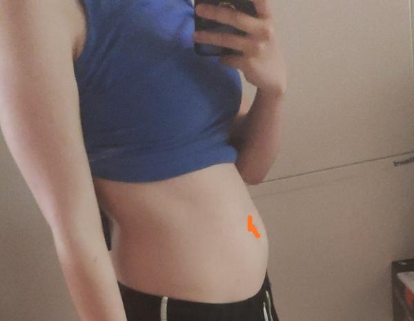 Už cca týdne zvětšené břicho. Můžu mít nějaký zánět?