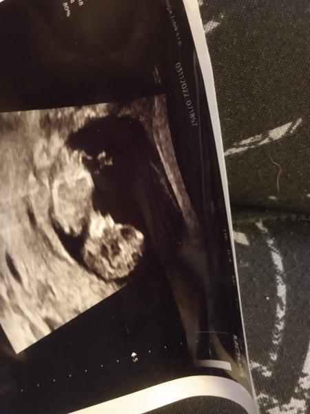 Jak odhadnout pohlaví dítěte podle fotografie?