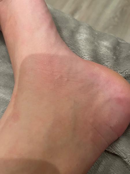 Vyrážka. Co by to mohlo být?