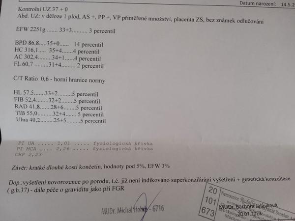 Krátké dlouhé kosti končetin pod 5 %: Je důvod k obavám?