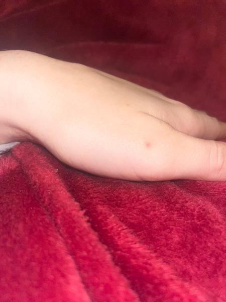 Jak řešit svědění a vyrážku na těle?