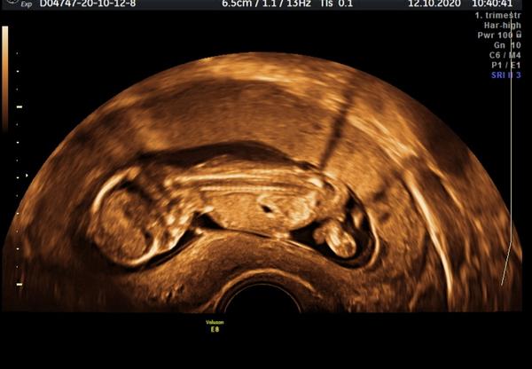 Co myslíte, je to kluk?