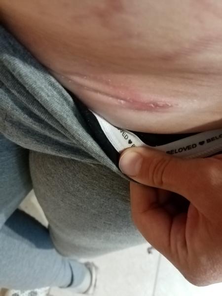 Císařsky řez. Co myslíte, že to je?