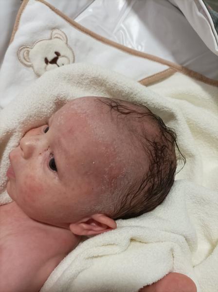 Kožní vyrážka a bílá mapa na čele při styku s vodou. Poradíte, prosím?