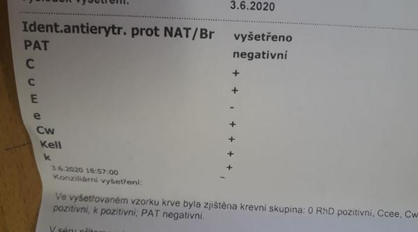 Výsledky krve z laboratoře. Rozumí těm písmenkům někdo?