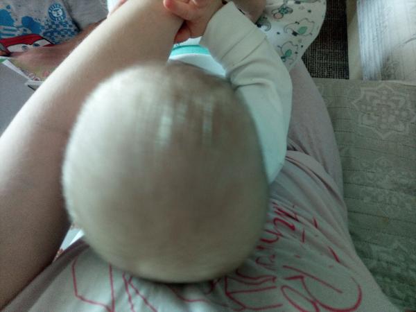 Plagiocefalie, máte ji? Řešíte?