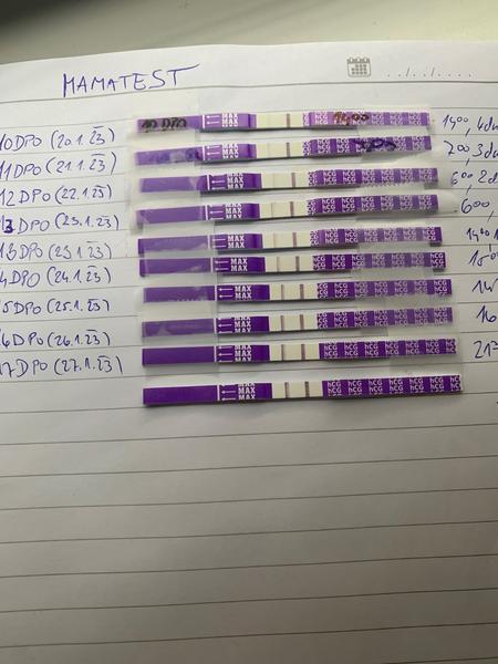 Jak se nezbláznit do první kontroly těhotenství?