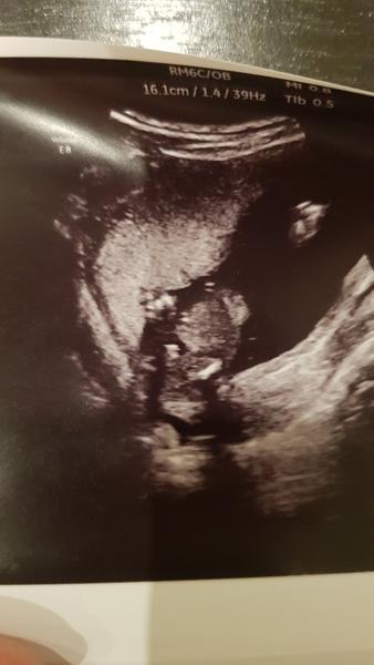 Kluk nebo holka. Poznáte z fotky pohlaví miminka?