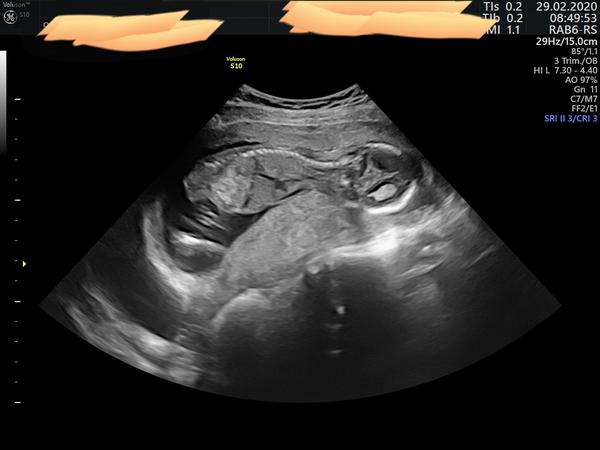 Co myslíte, co to bude?