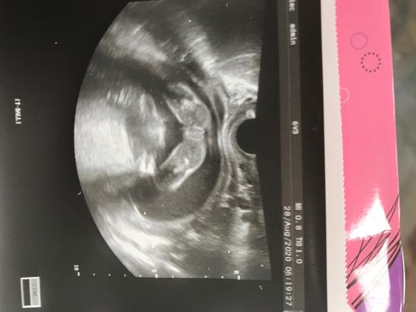 Chtěla jsem se zeptat, co si myslíte, že to bude?🤰🏻