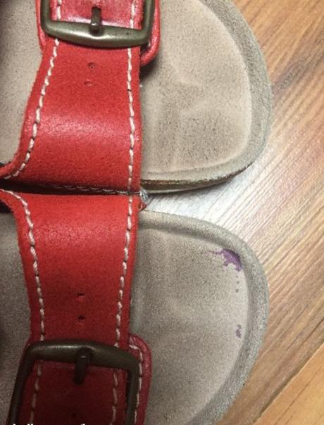 Zdravotní pantofle santé, vel. 32, santé,32